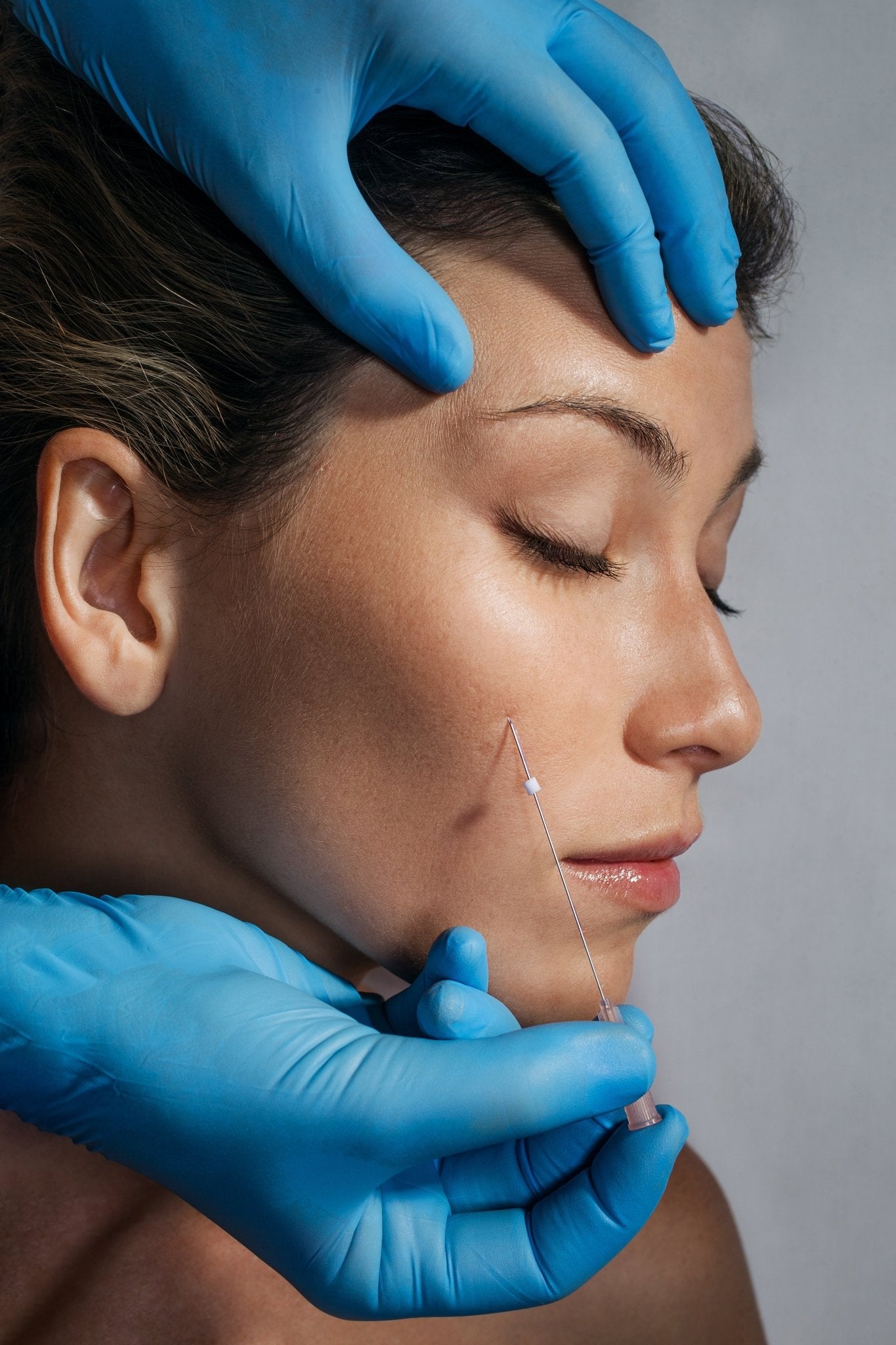 Thread Lifting - Arisam Cosmetic Clinic